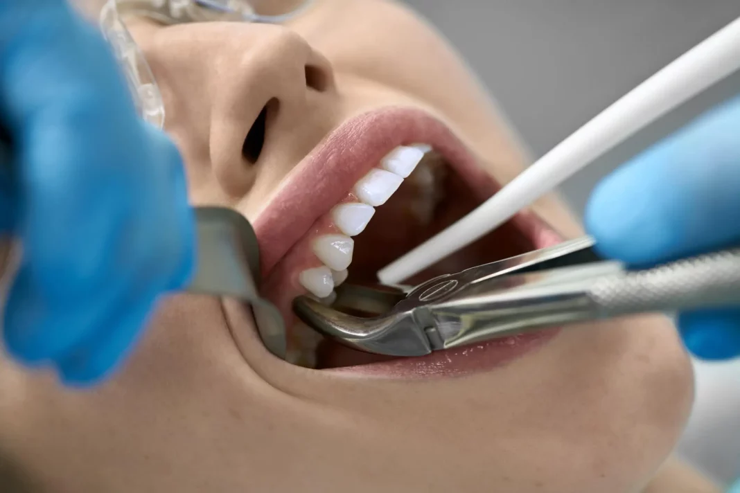 How Can I Make My Tooth Extraction Heal Faster