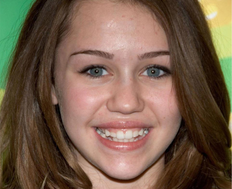 Miley Cyrus Teeth before
