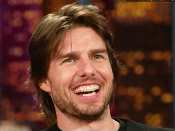 Tom Cruise Teeth after