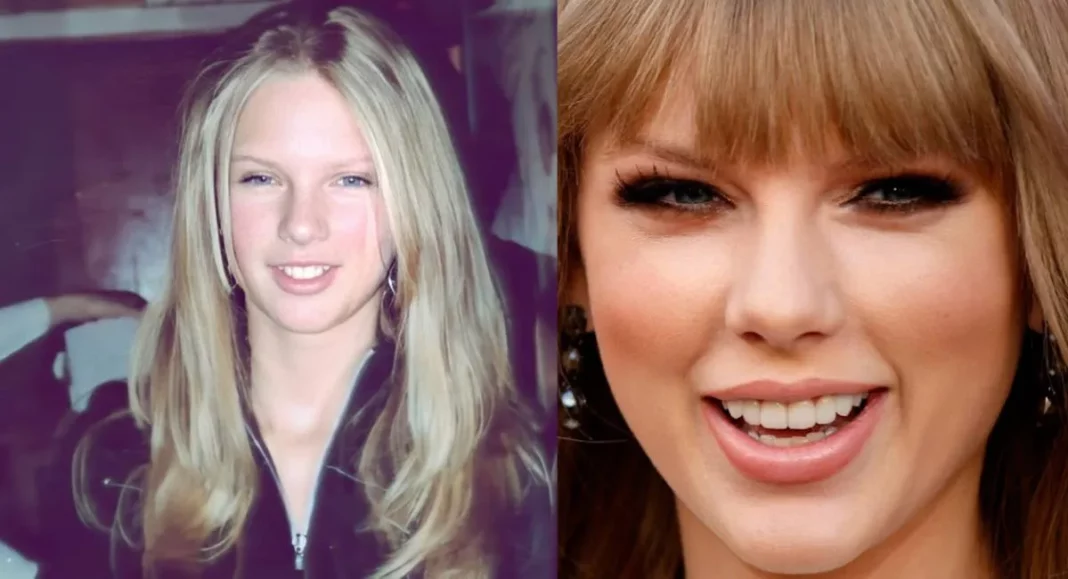 Taylor Swift teeth