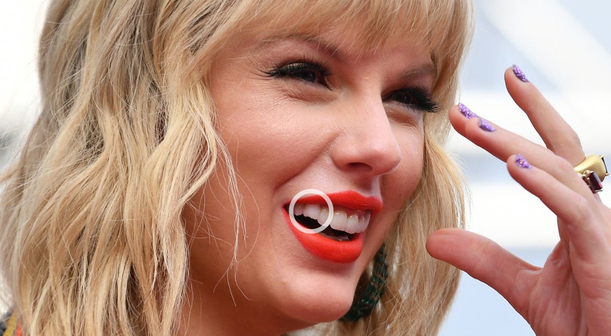 Taylor Swift Chipped Tooth